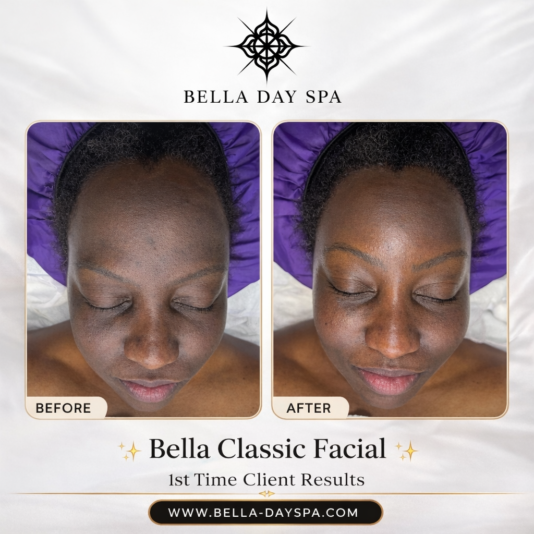 298A935F-18AC-4181-B994-163484C50F8A